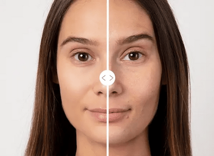 Kit Anti Edad Ácido Hialurónico Skin Care