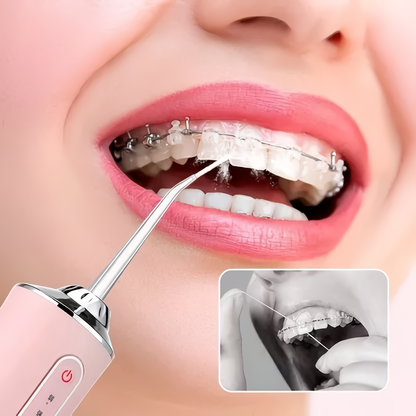 Irrigador Bucal De Dientes Portátil Usb